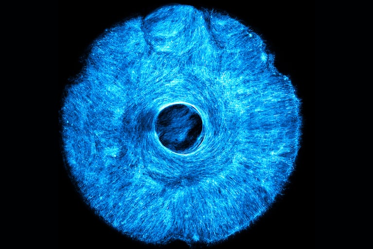 El desarrollo se inspira en el funcionamiento del iris humano, que contrae y dilata la pupila. (Foto: MIT)