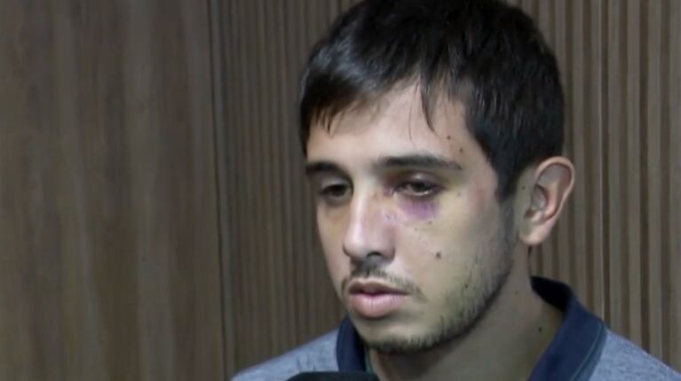 El crudo relato de un joven que fue atacado por una patota en un boliche: “Me patearon la cabeza sin piedad”